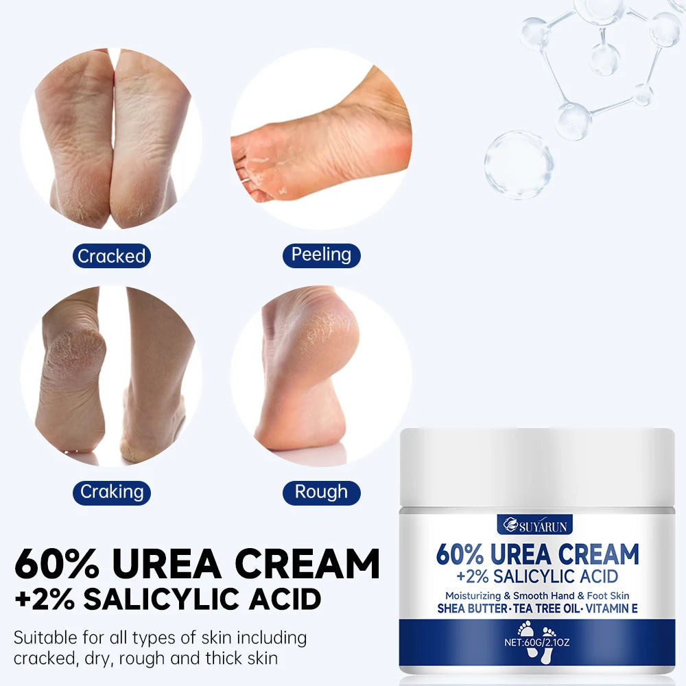 SUYARUN 60% Urea Foot Cream for Cracked Heels & Dry Skin - Intensive Moisturizing Treatment, Callus Remover, Diabetic Foot Care. TechVisio