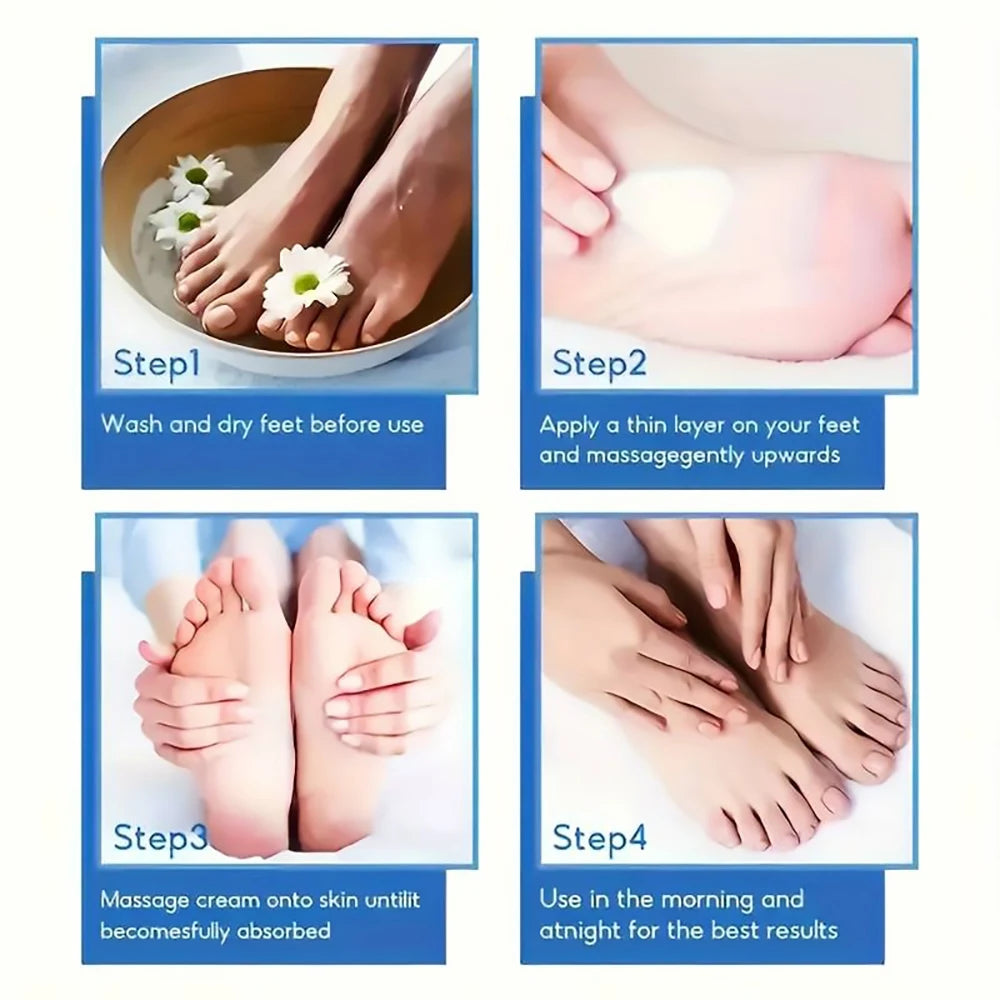SUYARUN 60% Urea Foot Cream for Cracked Heels & Dry Skin - Intensive Moisturizing Treatment, Callus Remover, Diabetic Foot Care. TechVisio