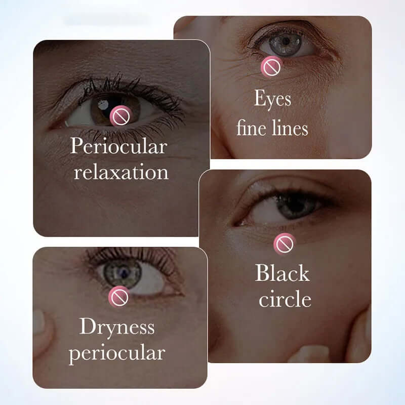 Crème Contour des Yeux Sakura SADOER – Anti-Cernes Rides Hydratante | 30ml+ TechVisio