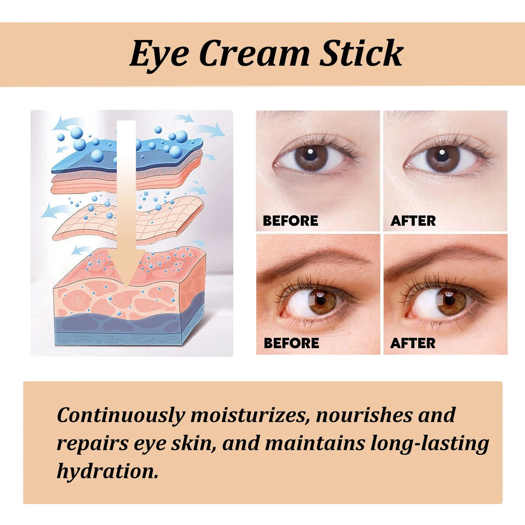 Snail Eye Cream Stick Collagen Fade Fine Lines Wrinkle Lightening Dark Circles Firming Eye Bags Puffiness Moisturizing Eye Cream TechVisio